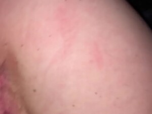 Thumb 7