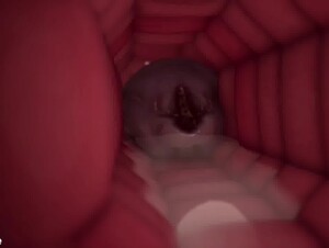 Thumb 6