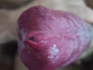 Thumb 8
