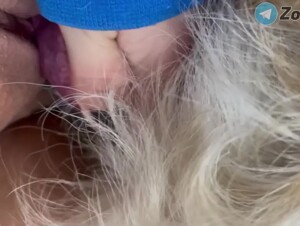 Thumb 8