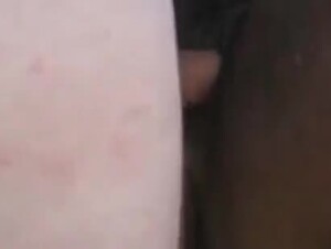 Thumb 8