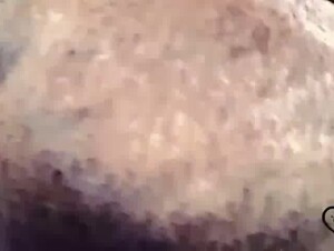 Thumb 6