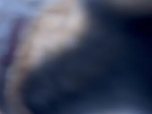 Thumb 8