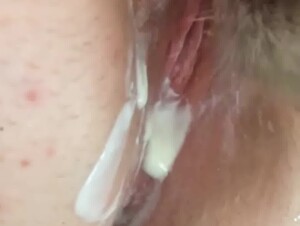 Thumb 6