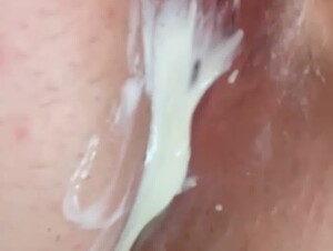 Thumb 8