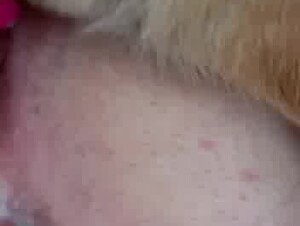 Thumb 10