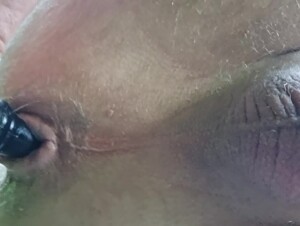 plaisir anal