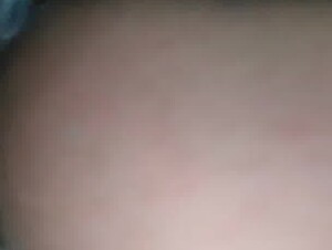 Thumb 6