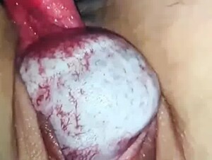 Thumb 6