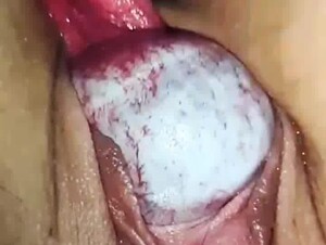 Thumb 7