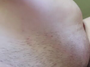 Thumb 10