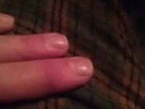 Thumb 9
