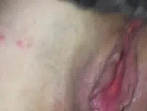 Thumb 7