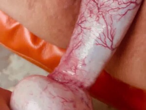 Thumb 9