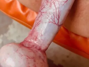 Thumb 6
