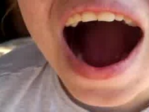 Thumb 10