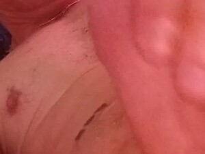 Thumb 8