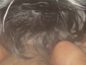 Thumb 9